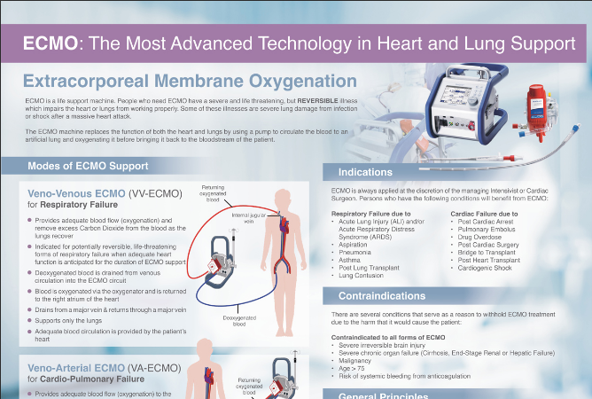 ECMO: The Most Advanced Technology in Heart and Lung Support