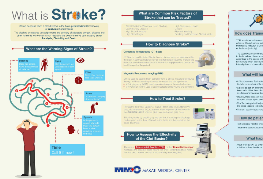 What is Stroke?