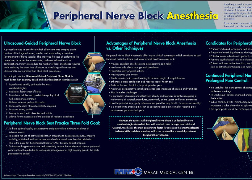 Peripheral Nerve Block Anesthesia (2018)