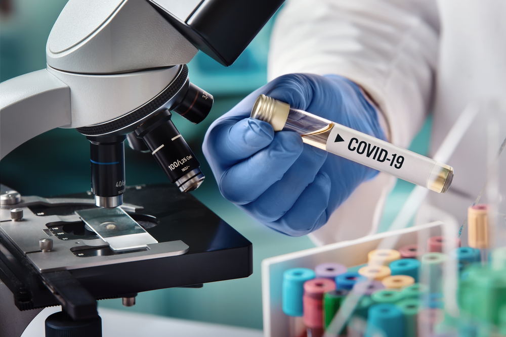 scientist holding COVID-19 test tube near microscope