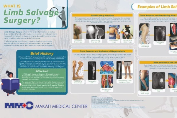 Limb Salvage Surgery thumbnail