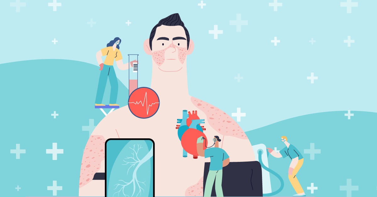 Understanding Lupus: Causes, Diagnosis, and Management poster
