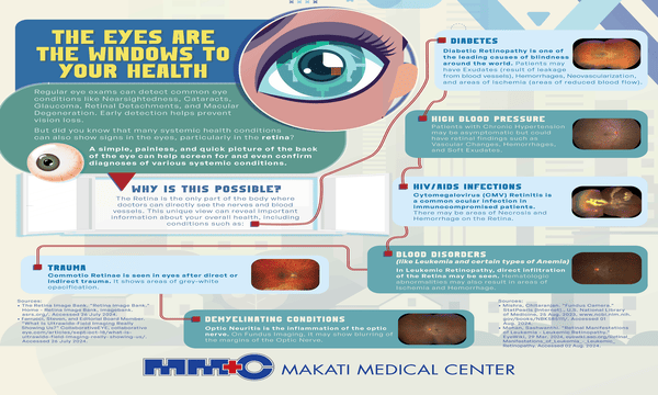 The Eyes Are The Windows To Your Health thumbnail