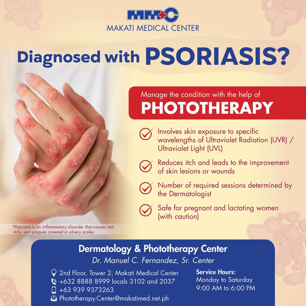 phototherapy poster for psoriasis